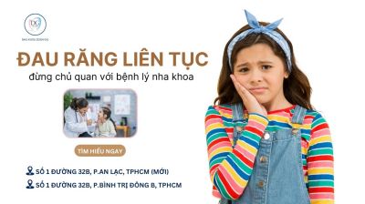 ĐAU RĂNG LIÊN TỤC SAU HÈ – ĐỪNG CHỦ QUAN VỚI CÁC BỆNH LÝ NHA KHOA