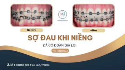 NIỀNG RĂNG CÓ ĐAU KHÔNG?