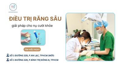 ĐIỀU TRỊ RĂNG SÂU SAU MÙA HÈ – GIẢI PHÁP CHO NỤ CƯỜI KHỎE