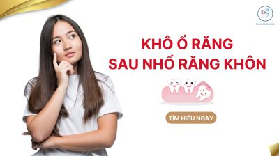 Nhổ răng kh&ocirc;n bị kh&ocirc; ổ răng ?