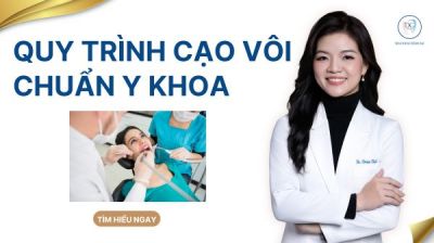 Quy tr&igrave;nh cạo v&ocirc;i răng &amp; đ&aacute;nh b&oacute;ng răng chuẩn nha khoa