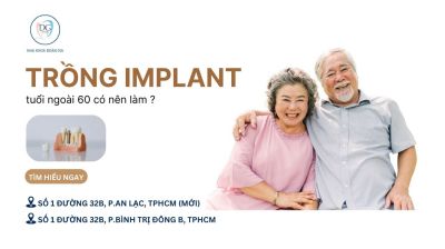 CÓ NÊN TRỒNG IMPLANT KHI TUỔI ĐÃ NGOÀI 60?