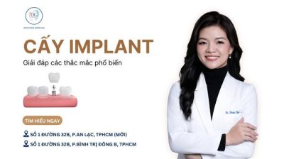 GIẢI ĐÁP CÁC THẮC MẮC PHỔ BIẾN VỀ CẤY GHÉP IMPLANT