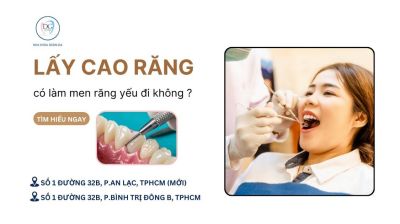 VÌ SAO CẦN LẤY CAO RĂNG ĐỊNH KỲ ĐỂ NGỪA VIÊM NƯỚU