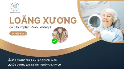 NGƯỜI BỊ LOÃNG XƯƠNG CÓ CẤY IMPLANT ĐƯỢC KHÔNG?