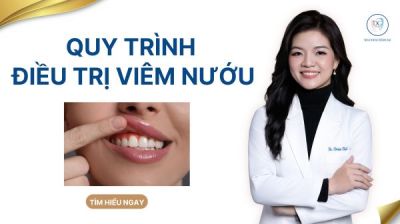 Quy tr&igrave;nh điều trị vi&ecirc;m nướu &ndash; vi&ecirc;m nha chu tại nha khoa