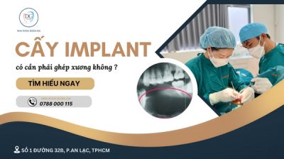 Trồng răng Implant có cần phải ghép xương không?