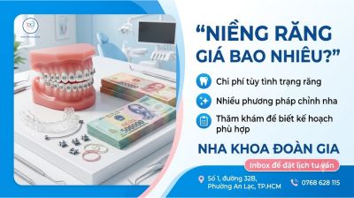 Niềng Răng Gi&aacute; Bao Nhi&ecirc;u? Chi Ph&iacute; Niềng Răng Tại B&igrave;nh T&acirc;n