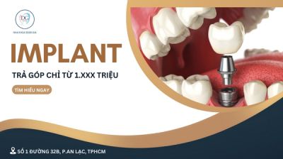 IMPLANT TRẢ G&Oacute;P CHỈ TỪ 1.XXX.000/TH&Aacute;NG &ndash; RĂNG MỚI, T&Uacute;I TIỀN VẪN &Ecirc;M!