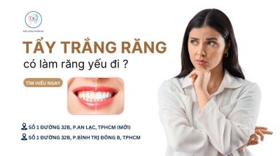 TẨY TRẮNG RĂNG CÓ LÀM MEN RĂNG YẾU ĐI KHÔNG?
