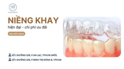 NI&Ecirc;NG KHAY HIỆN ĐẠI CHI PH&Iacute; SI&Ecirc;U ƯU Đ&Atilde;I