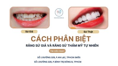 CÁCH PHÂN BIỆT RĂNG SỨ GIẢ VÀ RĂNG SỨ THẨM MỸ TỰ NHIÊN