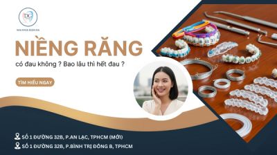 NIỀNG RĂNG C&Oacute; ĐAU KH&Ocirc;NG? BAO L&Acirc;U TH&Igrave; SẼ HẾT ĐAU?