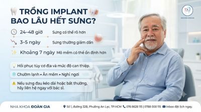 Trồng Implant bao l&acirc;u hết sưng?