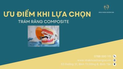 Trám răng composite – Giải pháp tái tạo răng Nhanh &amp; An toàn