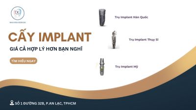 Trồng răng Implant mất bao lâu thì sẽ hoàn tất?