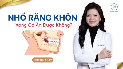 NHỔ RĂNG KH&Ocirc;N XONG C&Oacute; ĂN ĐƯỢC KH&Ocirc;NG ?